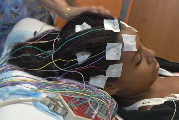 Electroencephalogram Eeg Uses Procedure Results